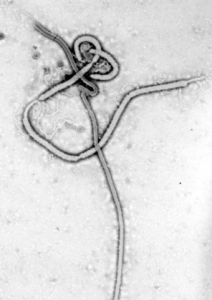 Ebola-Virus - Bildquelle: Wikipedia / CDC - Dr. Frederick A. Murphy