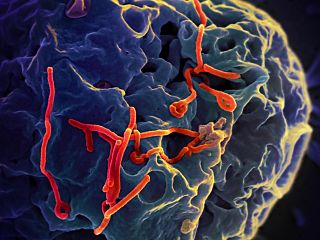 Ebola-Virus - Bildquelle: Wikipedia / NIAID