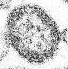 Masern-Virus - Bildquelle: Wikipedia / CDC/ Courtesy of Cynthia S. Goldsmith; William Bellini, Ph.D.